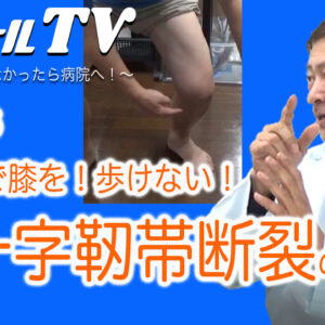15,テニスで膝を！前十字靭帯断裂の対処法